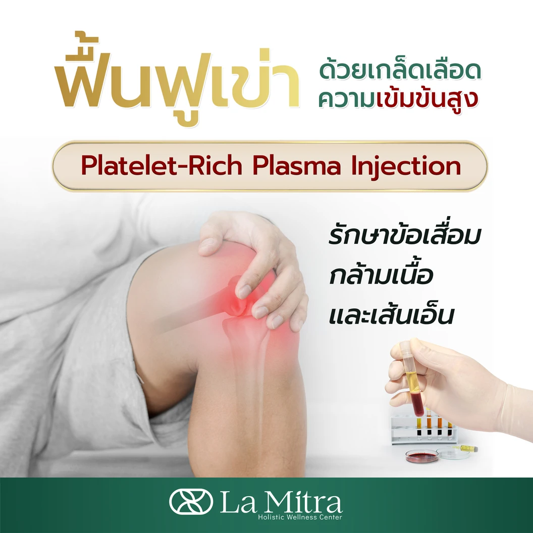 โปรแกรม PRP รักษาข้อเข่า 1 ข้าง ด้วยเกล็ดเลือดเข้มข้น