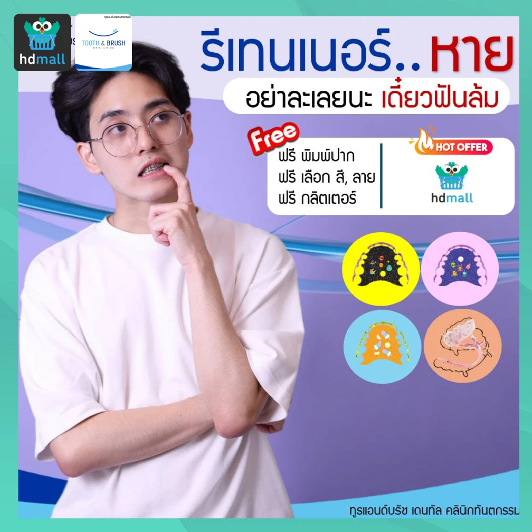 ทำรีเทนเนอร์ลวด 1 ชิ้น