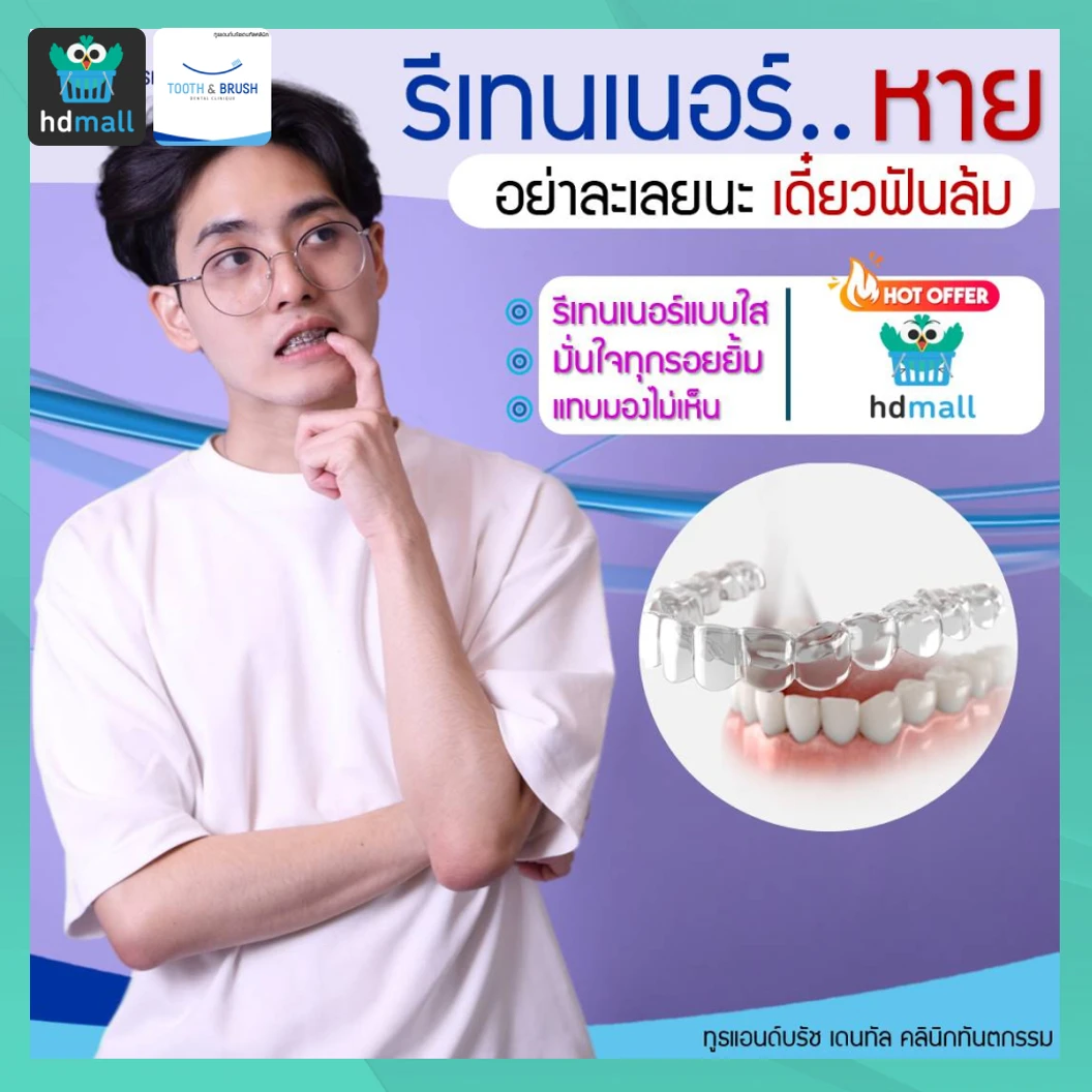 ทำรีเทนเนอร์ใส 2 ชิ้น