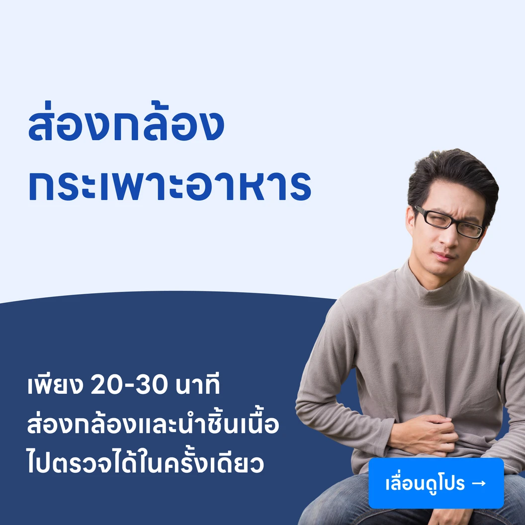 ส่องกล้องกระเพาะอาหาร