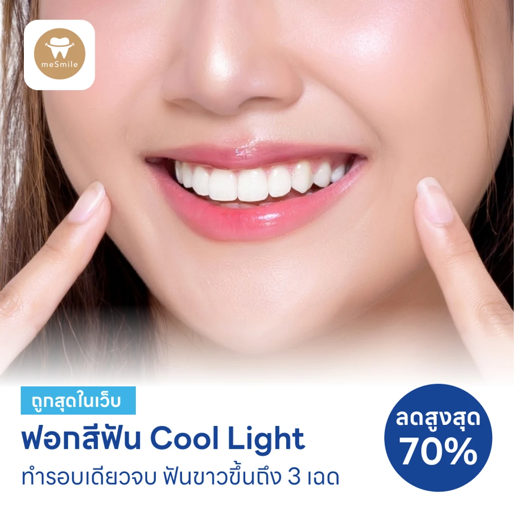 ฟอกสีฟันที่คลินิก ด้วยระบบ Cool Light