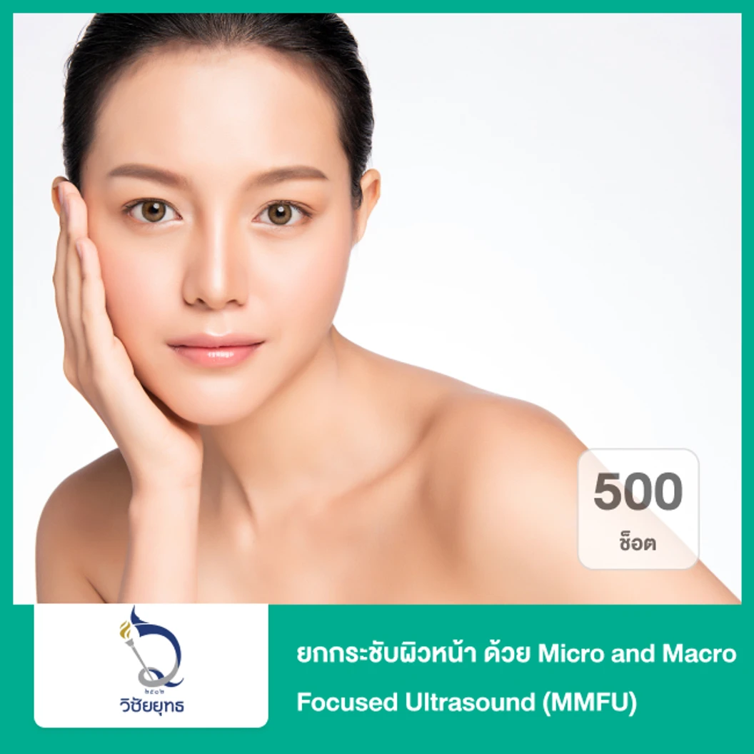 ยกกระชับผิวหน้า ด้วย Micro and Macro Focused Ultrasound (MMFU) 500 ช็อต