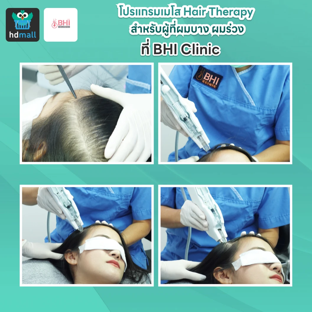 โปรแกรมเมโส Hair Therapy สำหรับผู้ที่ผมบาง ผมร่วง