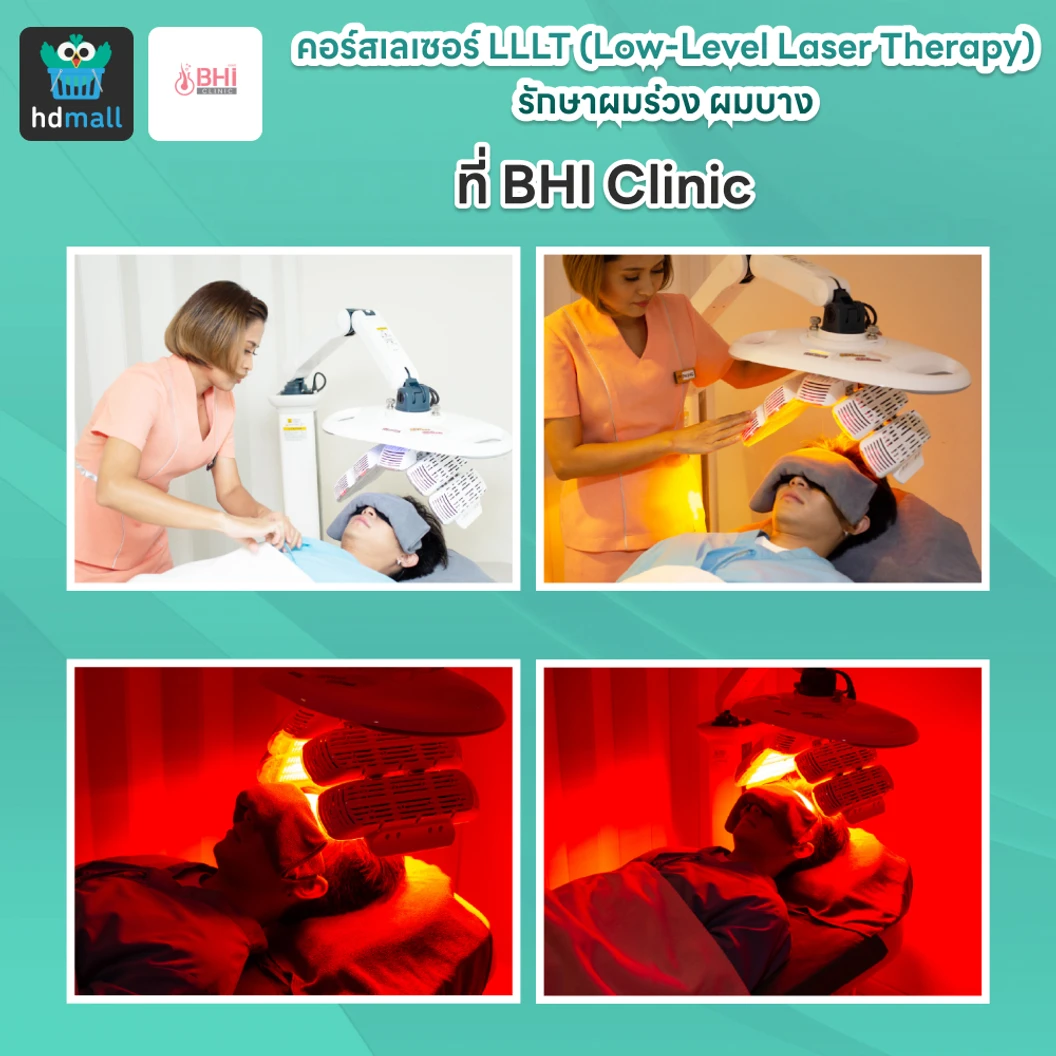 คอร์สเลเซอร์ LLLT (Low-Level Laser Therapy) รักษาผมร่วง ผมบาง 10 ครั้ง ฟรี! 2 ครั้ง