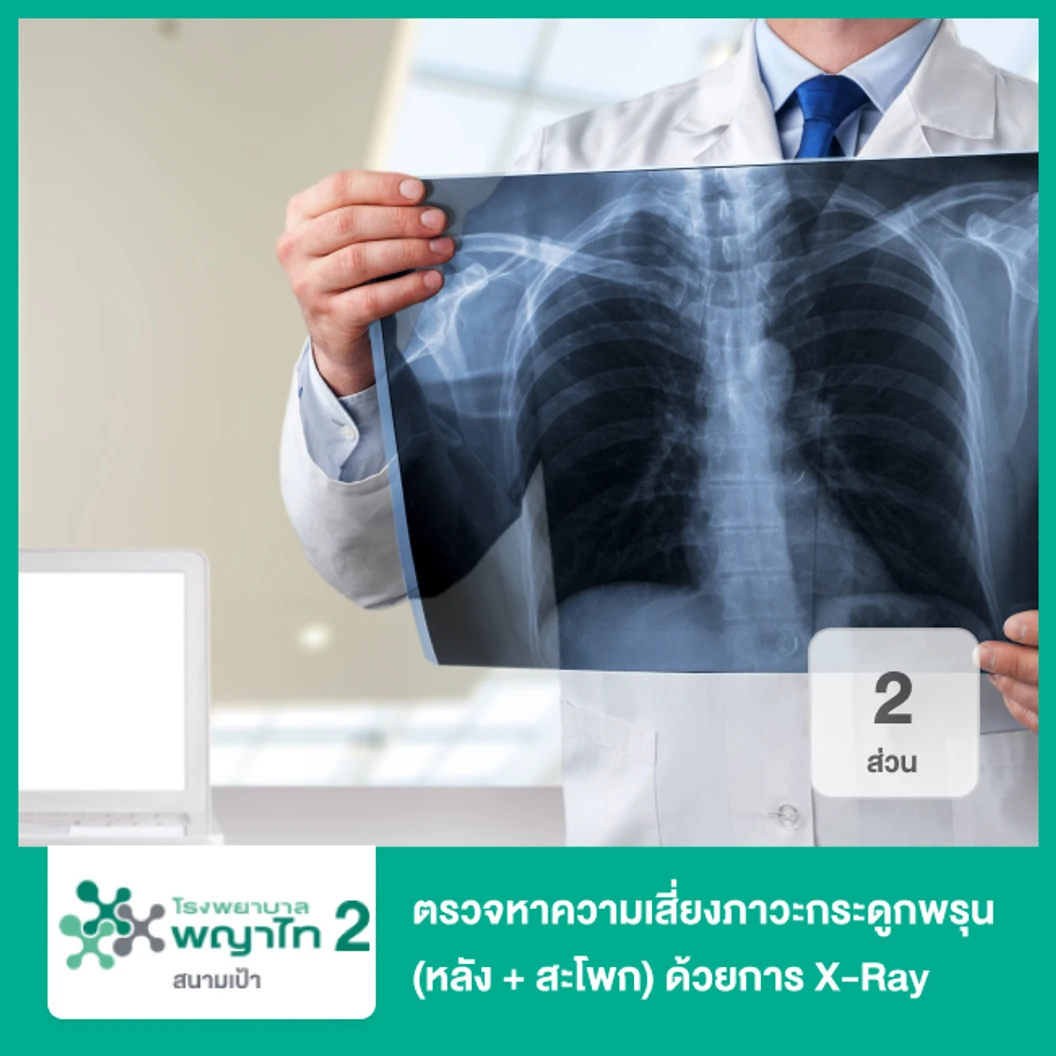 ตรวจหาความเสี่ยงภาวะกระดูกพรุน 2 ส่วน (หลัง + สะโพก) ด้วยการเอกซเรย์