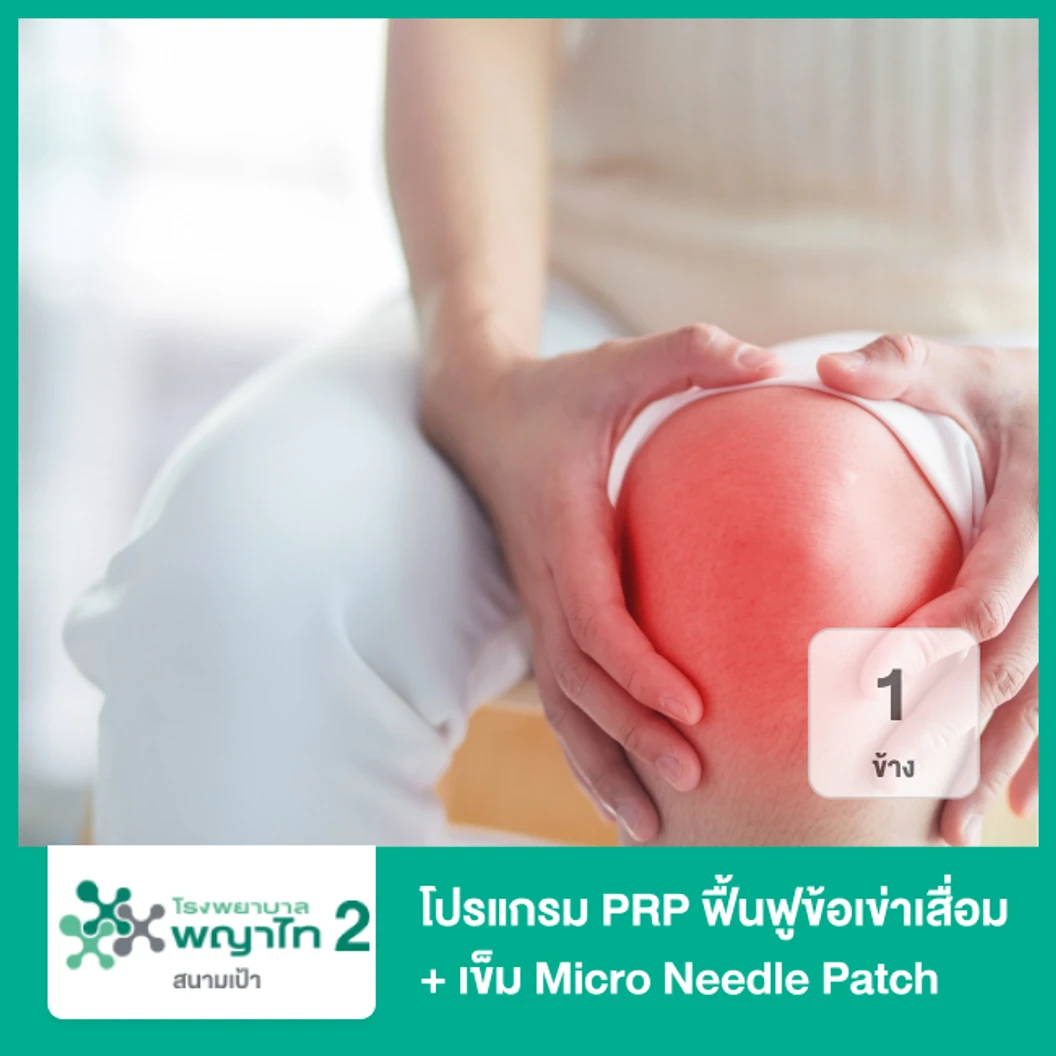 โปรแกรม PRP ฟื้นฟูข้อเข่าเสื่อมด้วยเกล็ดเลือดเข้มข้น 1 ข้าง (RegenKit PRP BCT-3) + เข็ม Micro Needle Patch