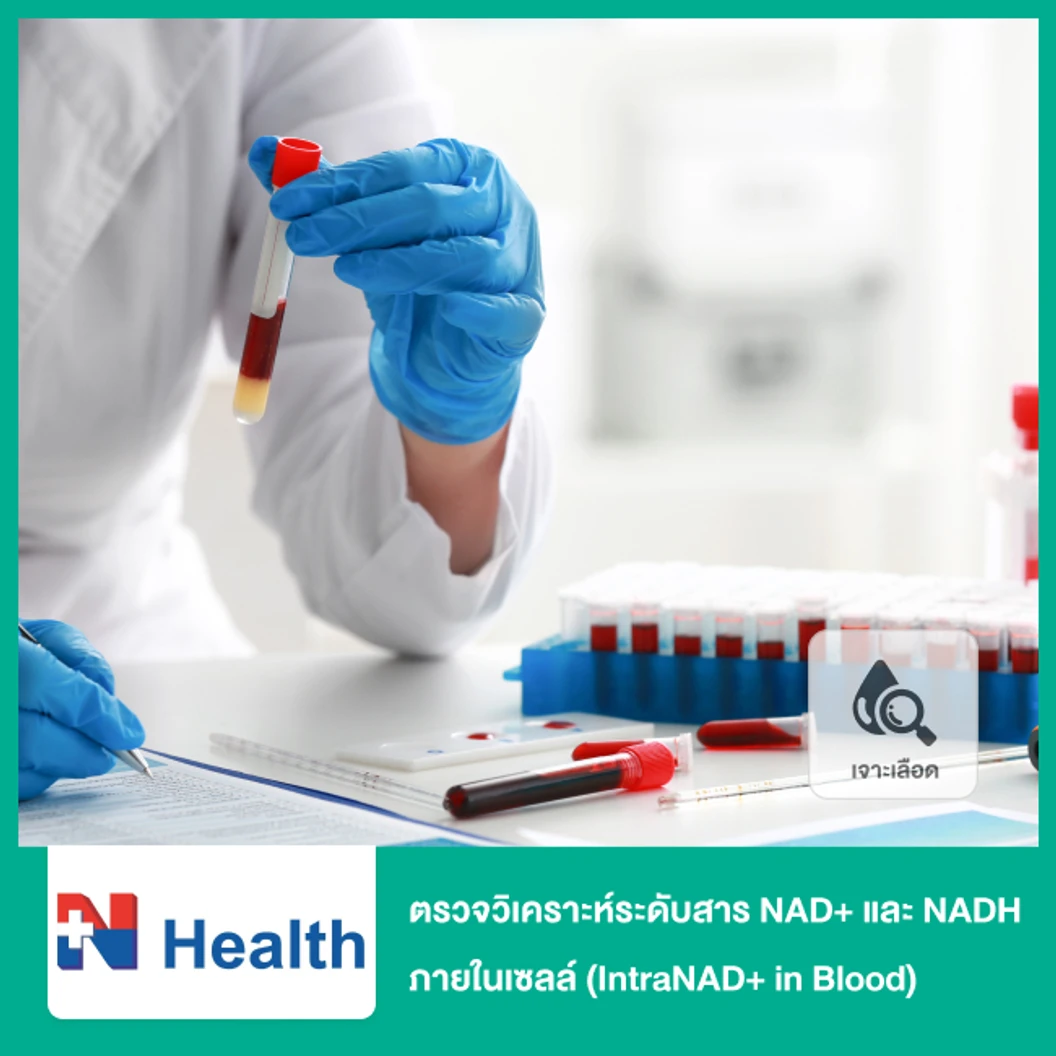 ตรวจวิเคราะห์ระดับสาร NAD+ และ NADH ภายในเซลล์ (IntraNAD+ in Blood) (เจาะเลือด)