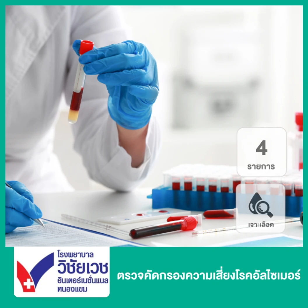 ตรวจคัดกรองความเสี่ยงโรคอัลไซเมอร์ 4 รายการ (เจาะเลือด)