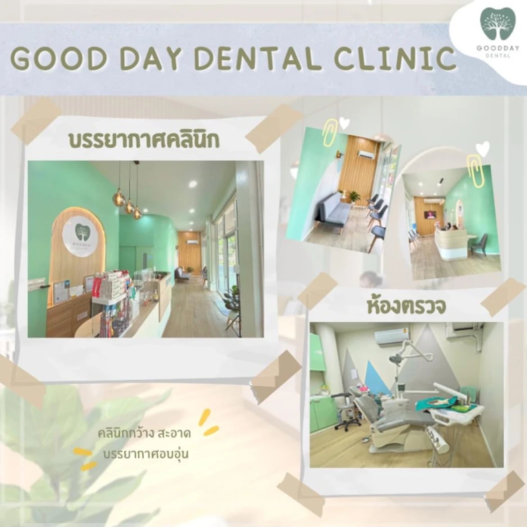 จัดฟันใส Invisalign Moderate 52 ชิ้น