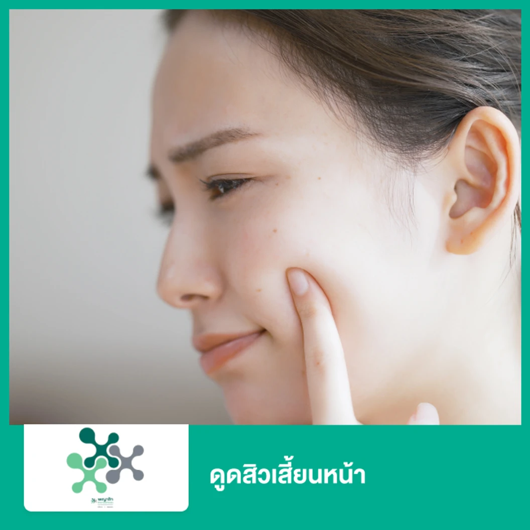 ดูดสิวเสี้ยนหน้า