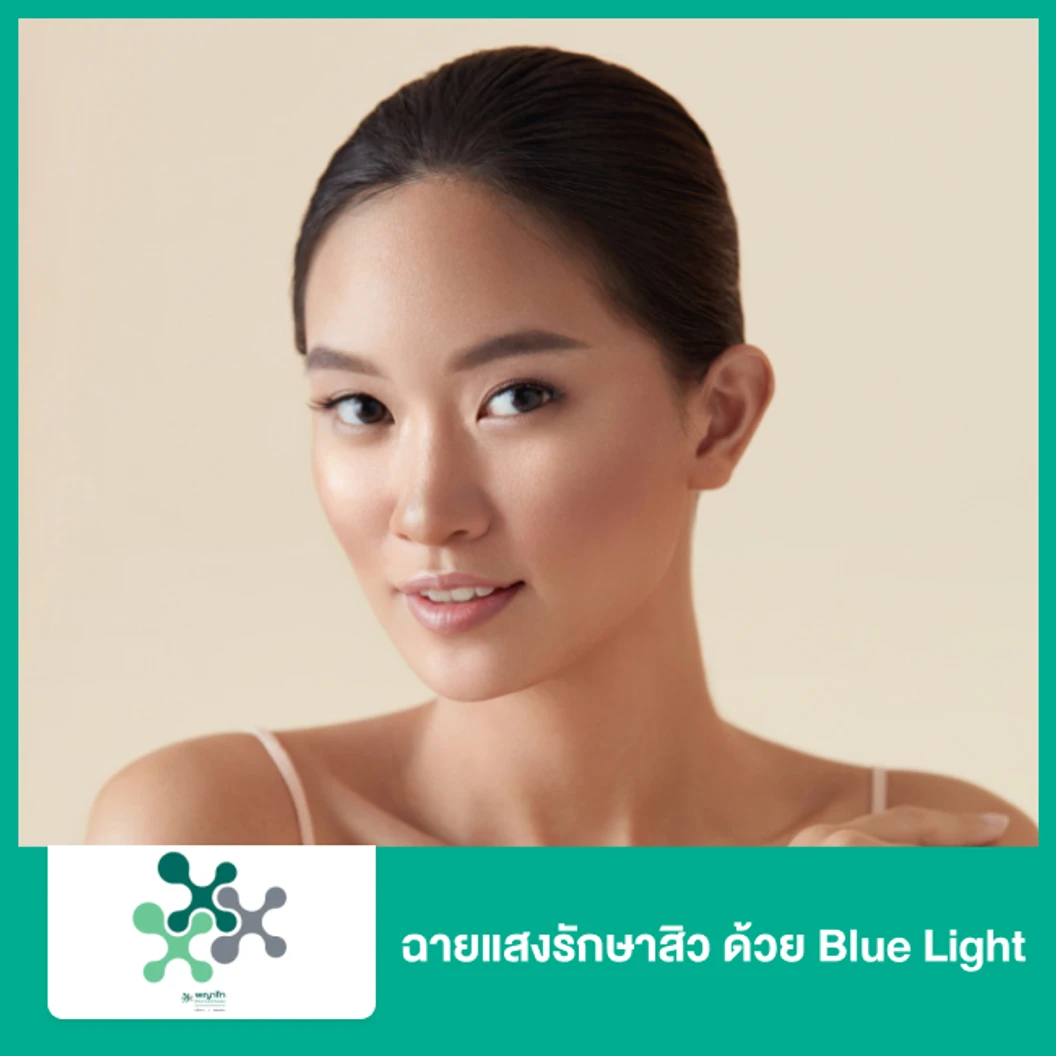 ฉายแสงรักษาสิว ด้วย Blue Light
