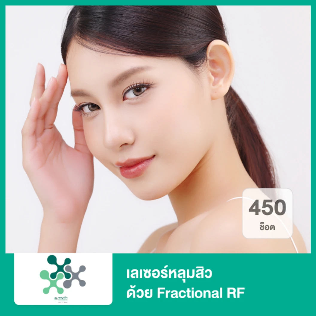 เลเซอร์หลุมสิว ด้วย Fractional RF 450 ช็อต