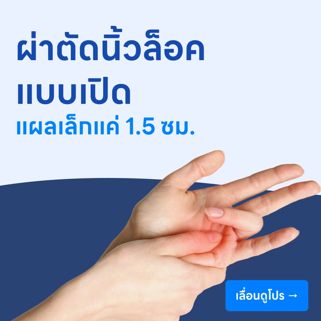 ผ่าตัดนิ้วล็อค