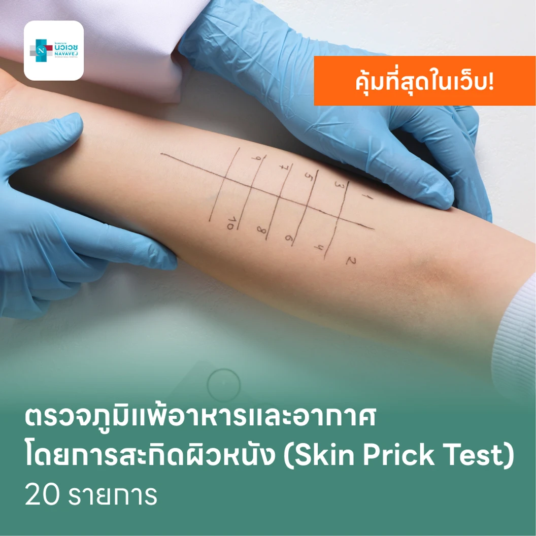 ตรวจหาสารก่อภูมิแพ้อาหารและสารก่อภูมิแพ้ในอากาศ 20 รายการ โดยการสะกิดผิวหนัง
