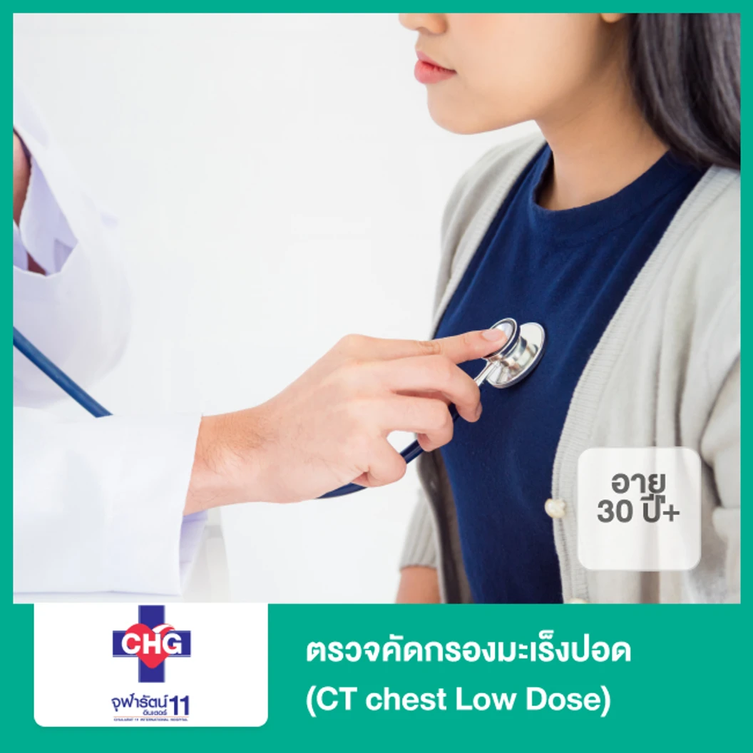 ตรวจคัดกรองมะเร็งปอด (CT chest Low Dose) (30 ปีขึ้นไป)