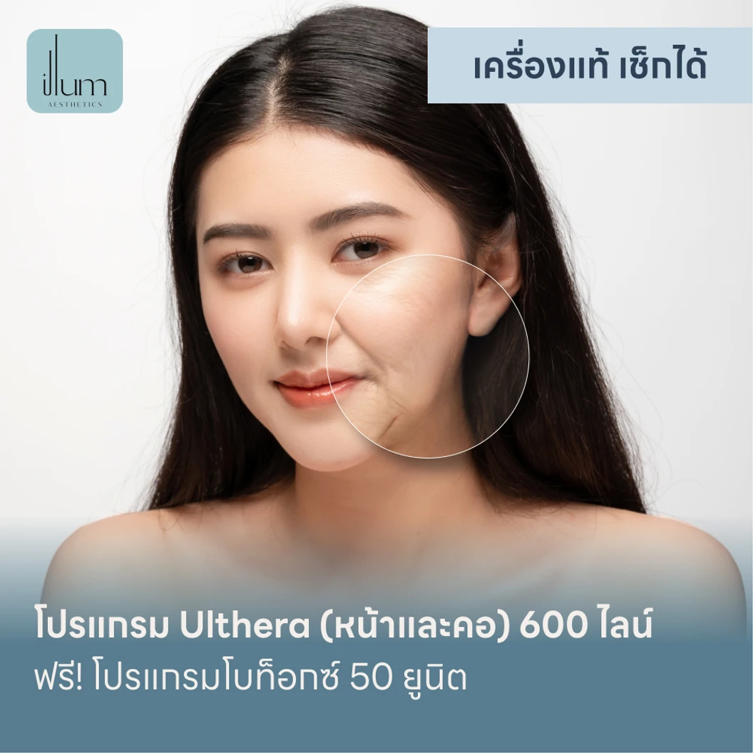 โปรแกรม Ulthera (หน้าและคอ) 600 ไลน์ ฟรี! โปรแกรมโบท็อกซ์ 50 ยูนิต