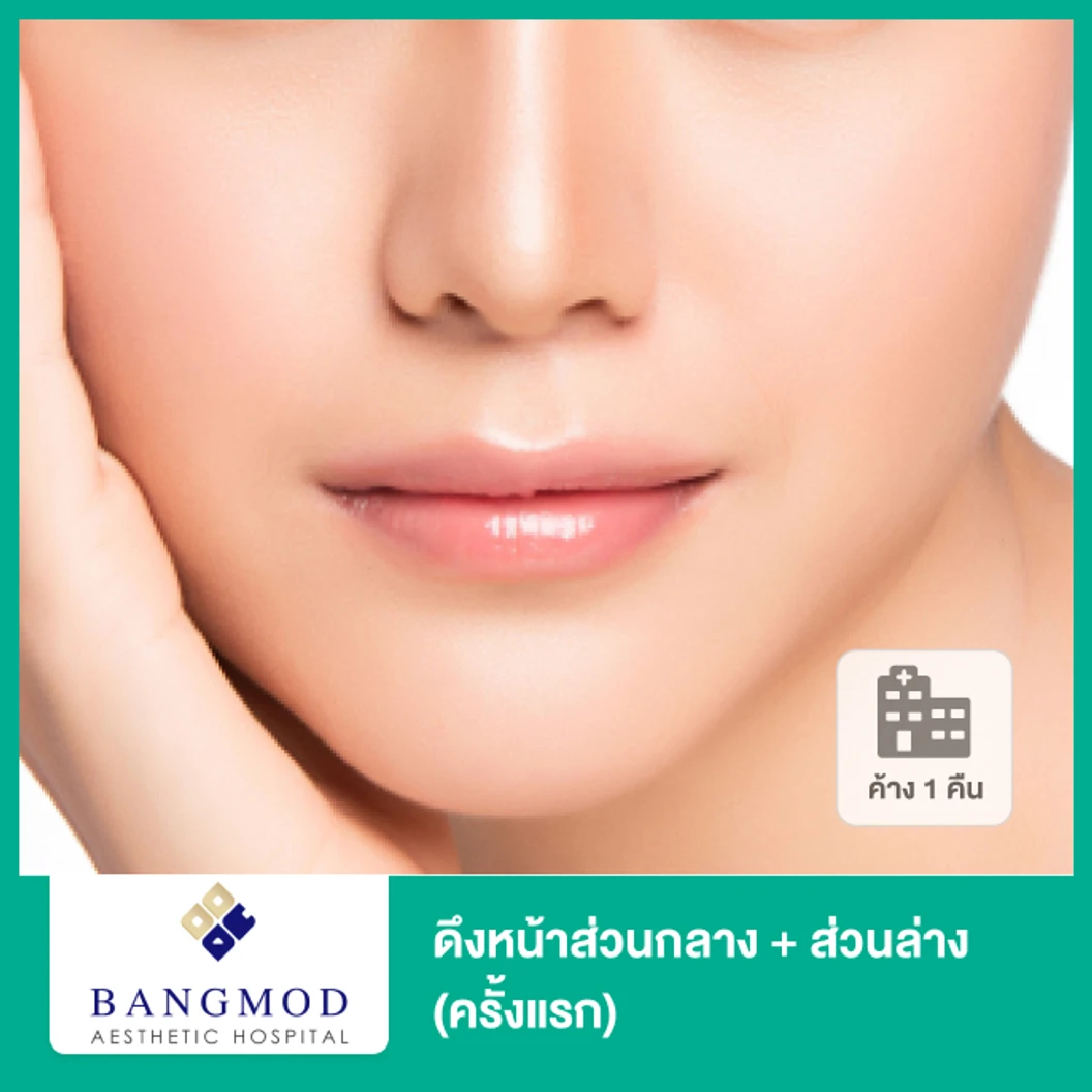 ดึงหน้าส่วนกลาง + ส่วนล่าง ด้วยเทคนิคพิเศษ Modern Facelift Plus เฉพาะที่ รพ. บางมด นอนพักที่ รพ. 2 วัน 1 คืน (ครั้งแรก)