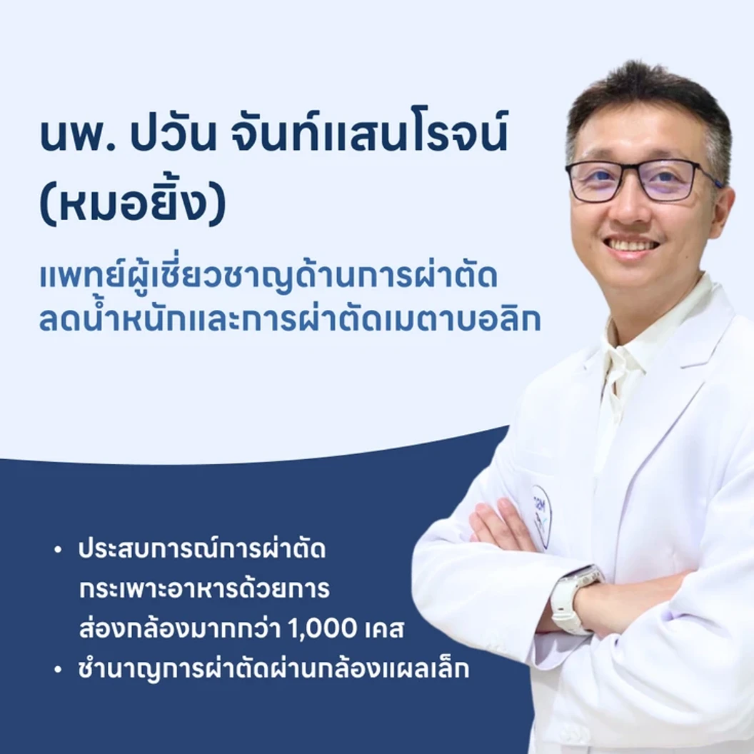 ผ่าตัดกระเพาะอาหารแบบสลีฟ เพื่อลดน้ำหนัก