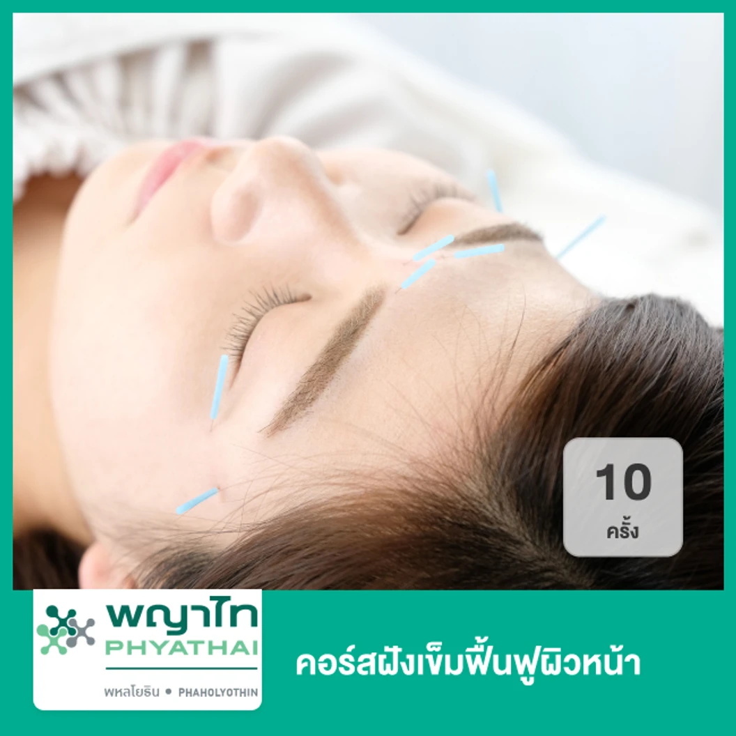 คอร์สฝังเข็มฟื้นฟูผิวหน้า 10 ครั้ง
