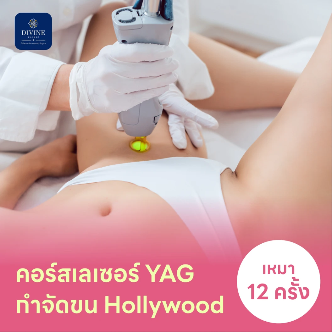 คอร์สเลเซอร์กำจัดขนน้องสาวแบบ Hollywood (vVIO) 12 ครั้ง ด้วย YAG Laser