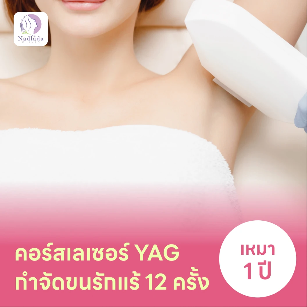 คอร์สเลเซอร์กำจัดขนรักแร้ 12 ครั้ง ด้วย YAG Laser (ผู้หญิงเท่านั้น)
