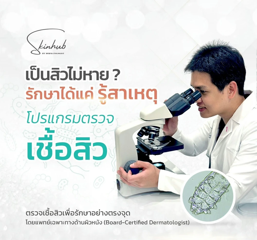 ตรวจหาเชื้อสิวหน้า พร้อมให้คำปรึกษาโดยแพทย์