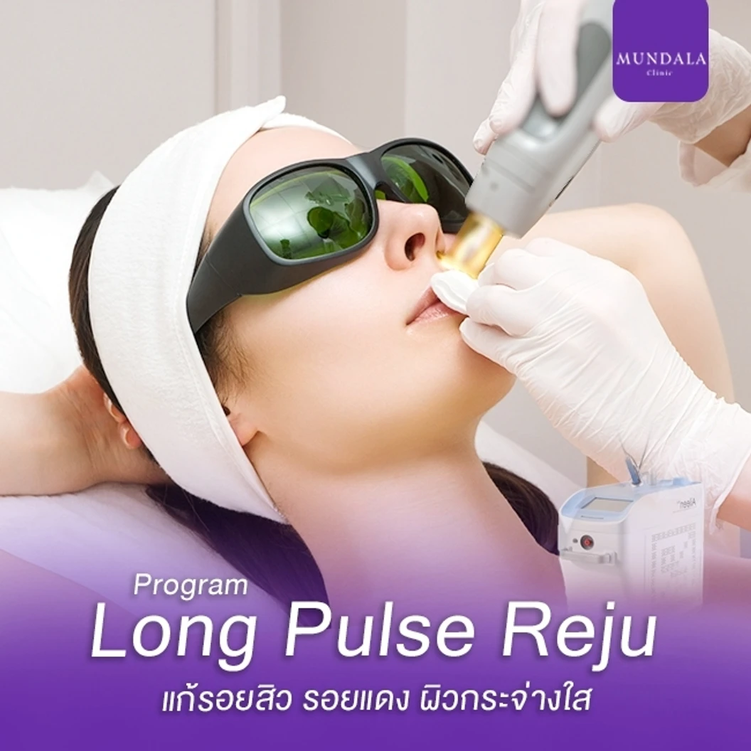 เลเซอร์ Long Pulse Reju หน้า แก้รอยสิว (จำนวนช็อตขึ้นอยู่กับแพทย์ประเมิน)