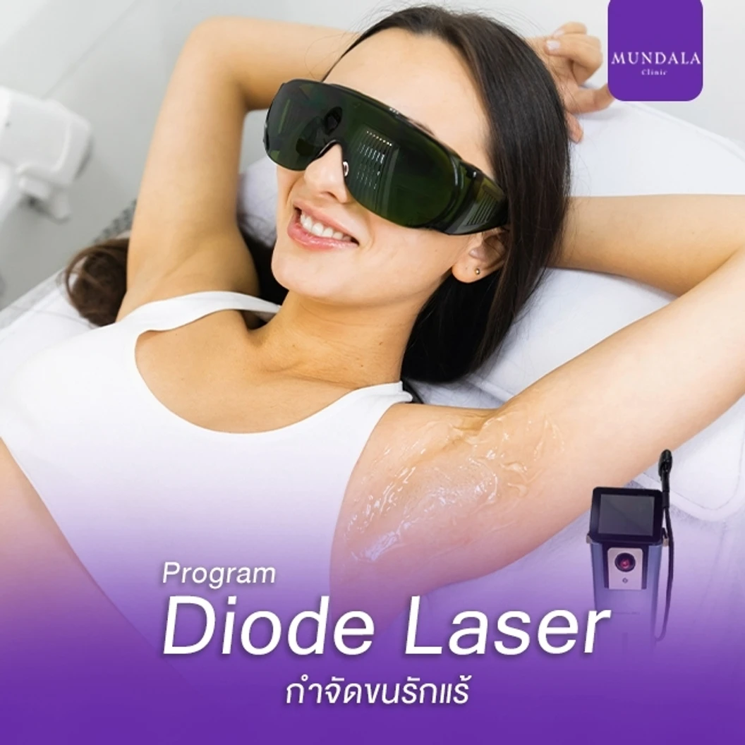 เลเซอร์ Diode กำจัดขนรักแร้ 1 ครั้ง