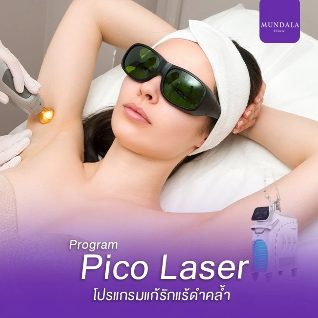เลเซอร์ Pico รักแร้ แก้ปัญหารักแร้ดำคล้ำ (จำนวนช็อตขึ้นอยู่กับแพทย์ประเมิน)