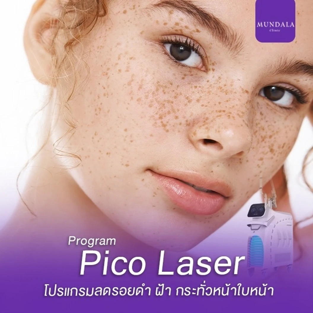 เลเซอร์ Pico หน้า ลดรอยดำ ฝ้า กระ (จำนวนช็อตขึ้นอยู่กับแพทย์ประเมิน)