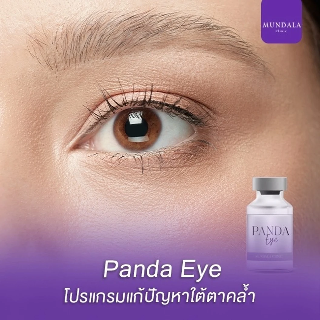 โปรแกรมเมโสใต้ตา (Panda Eye) แก้ปัญหาใต้ตาคล้ำ 1 ซีซี