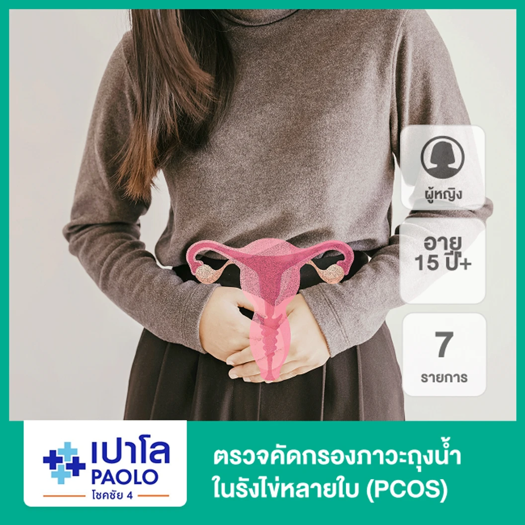 ตรวจคัดกรองภาวะถุงน้ำในรังไข่หลายใบ 7 รายการ (PCOS) (ผู้หญิง 15 ปีขึ้นไป)