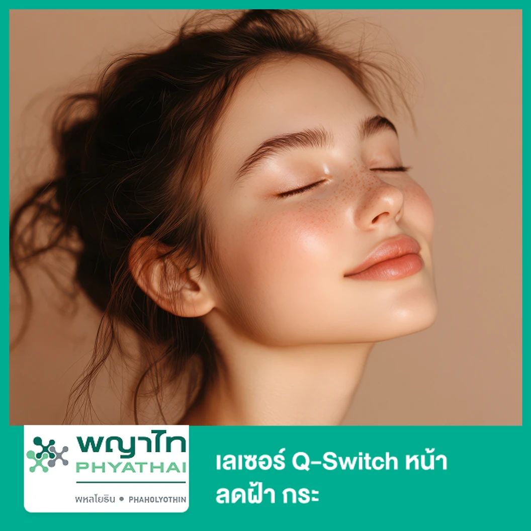 เลเซอร์ Q-Switch หน้า ลดฝ้า กระ