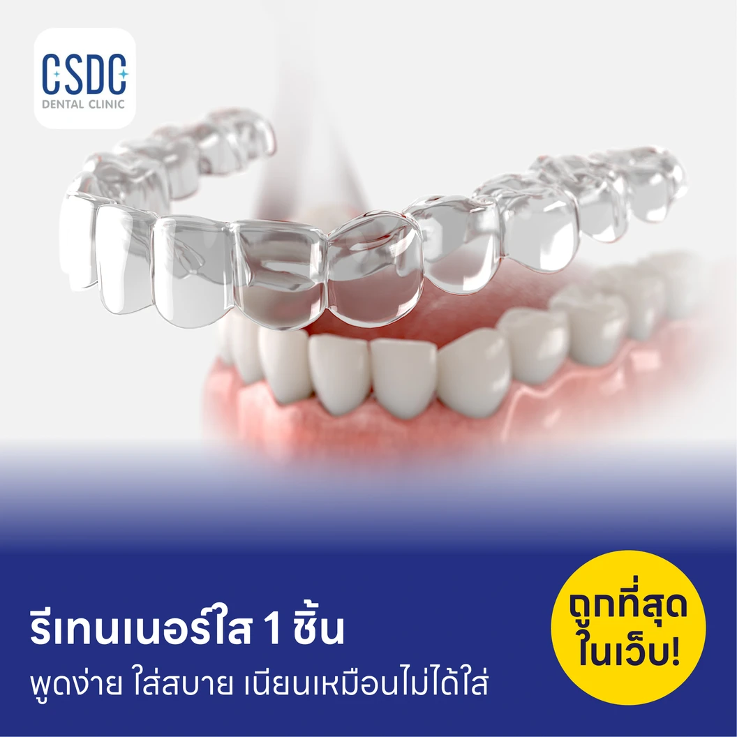 ทำรีเทนเนอร์แบบใส 1 ชิ้น ฟันบนหรือล่าง