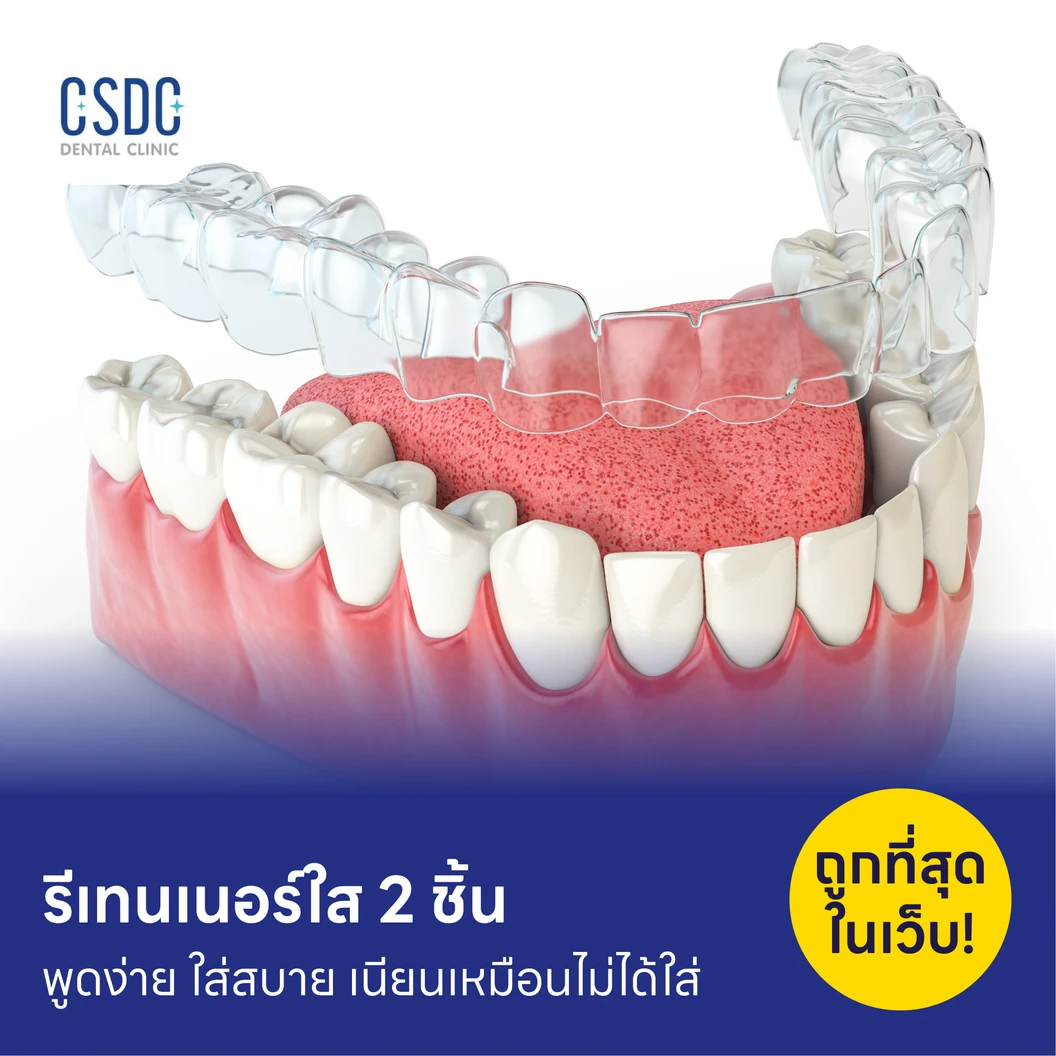 ทำรีเทนเนอร์แบบใส 2 ชิ้น ฟันบนและล่าง