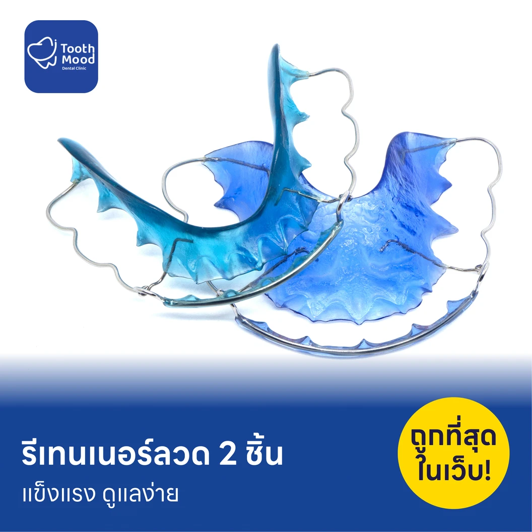 ทำรีเทนเนอร์แบบลวด 2 ชิ้น