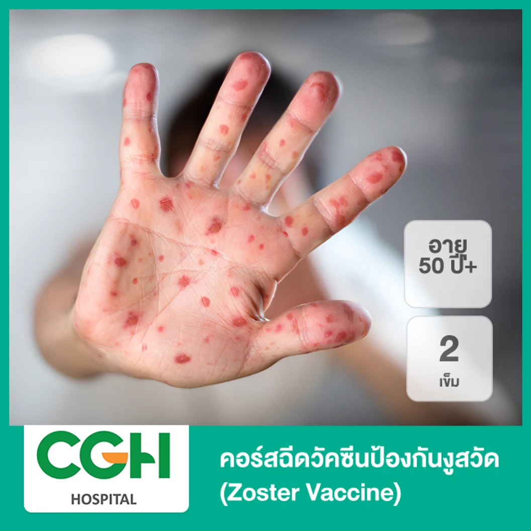 คอร์สฉีดวัคซีนป้องกันงูสวัด (Zoster Vaccine) 2 เข็ม (50 ปีขึ้นไป)