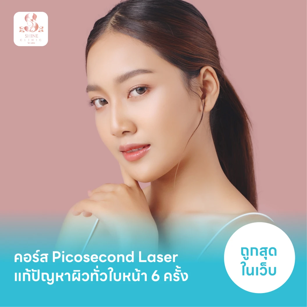 คอร์ส Picosecond Laser แก้ปัญหาผิวทั่วใบหน้า 6 ครั้ง