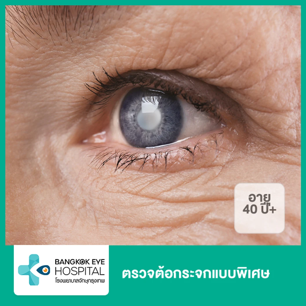 ตรวจต้อกระจกแบบพิเศษ (40 ปีขึ้นไป)