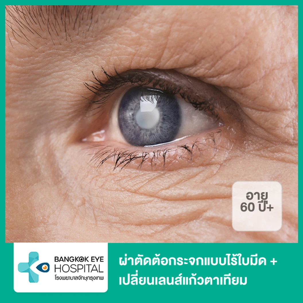 ผ่าตัดต้อกระจกแบบไร้ใบมีด + เปลี่ยนเลนส์แก้วตาเทียมหลายระยะ เกรดพรีเมียม 1 ข้าง (60 ปีขึ้นไป)