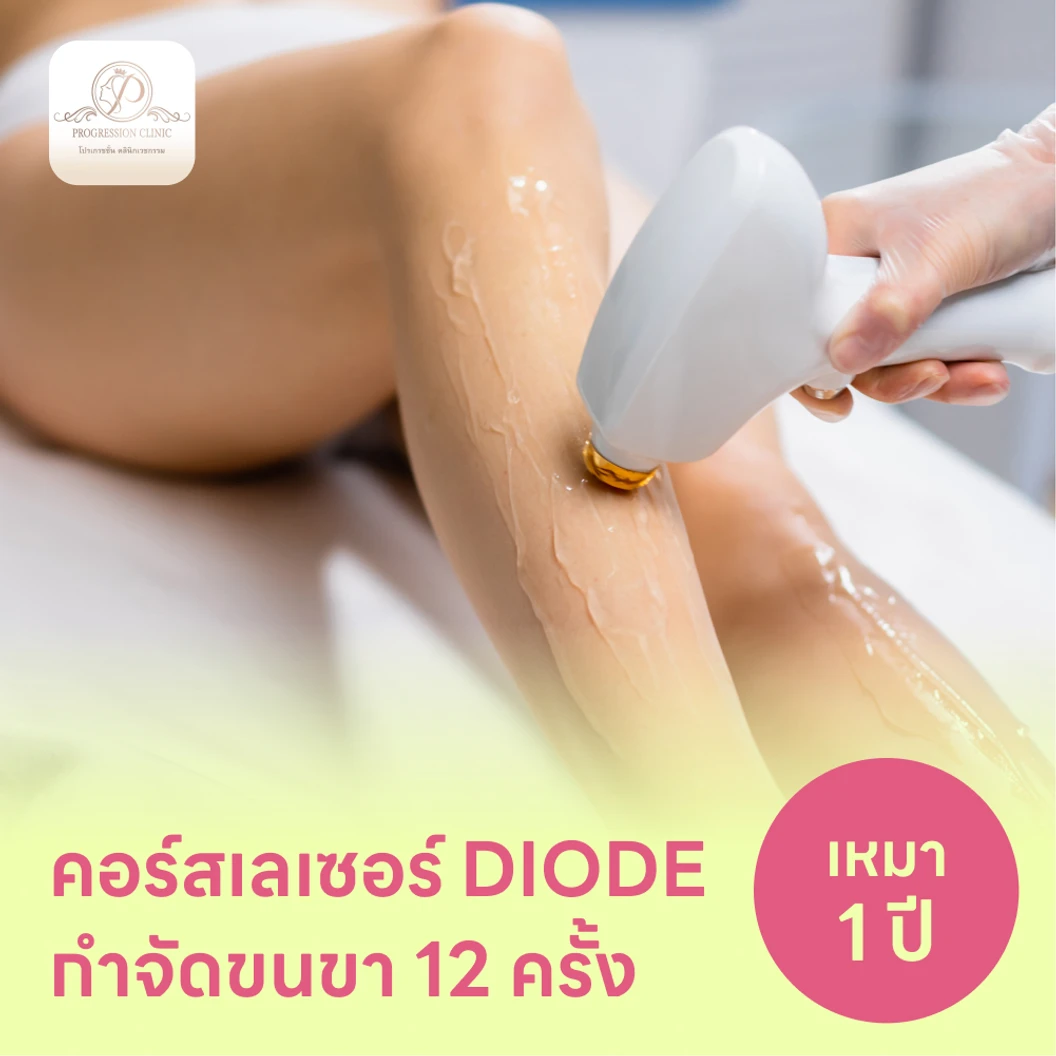 คอร์สเลเซอร์กำจัดขนทั่วขา 12 ครั้ง ด้วย Diode Laser
