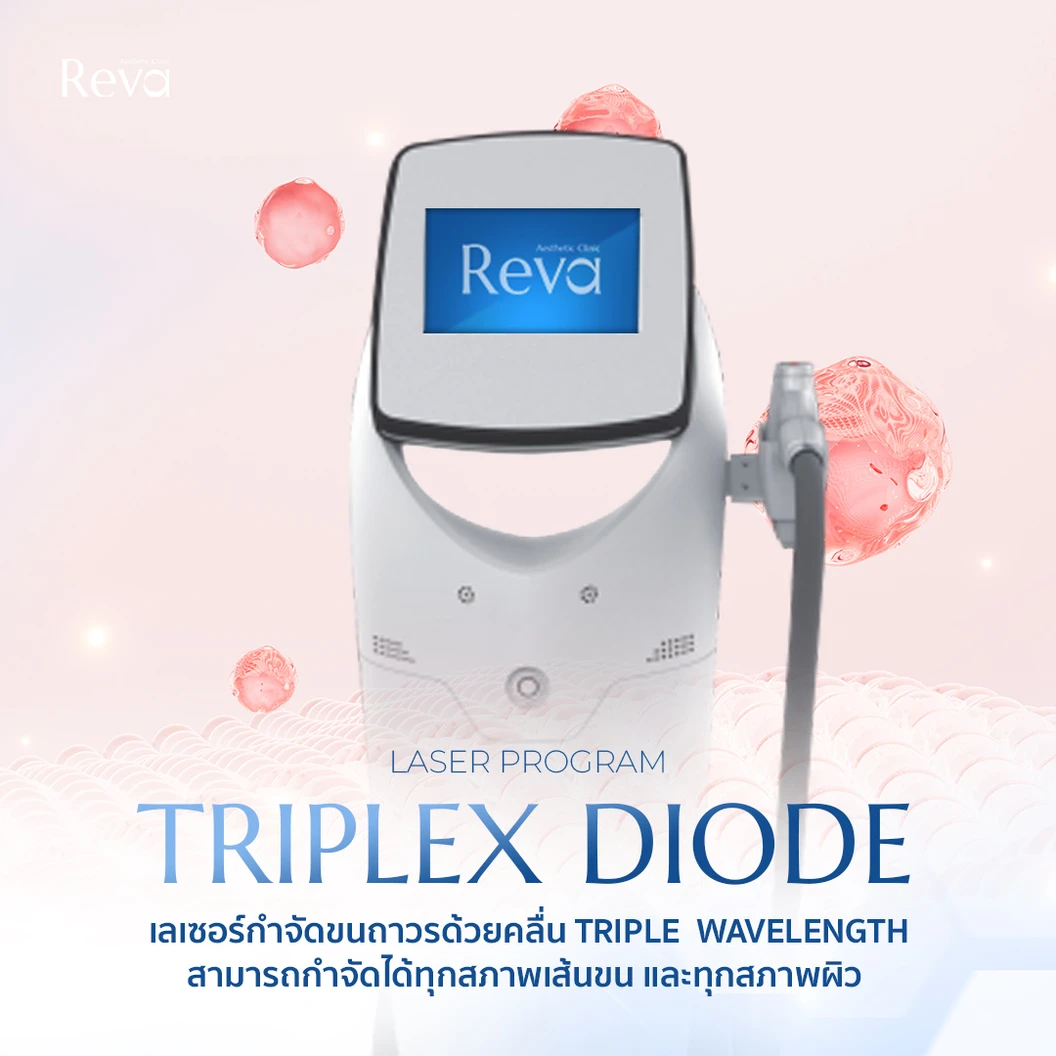 กำจัดขนทั่วใบหน้ารวมหนวดและเครา ด้วย Triplex Diode Laser 1 ครั้ง สำหรับผู้หญิงหรือผู้ชาย