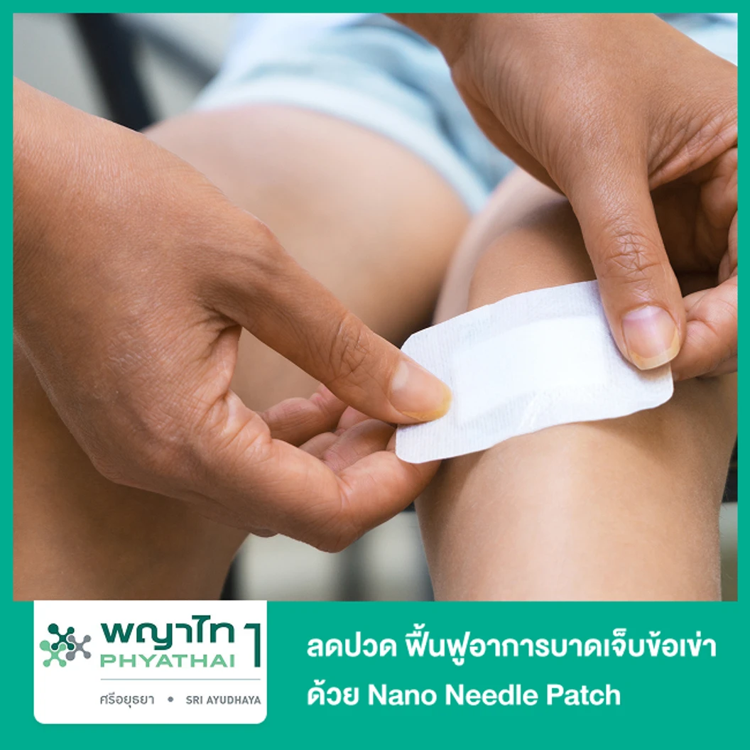ลดปวด ฟื้นฟูอาการบาดเจ็บข้อเข่า ด้วย Nano Needle Patch