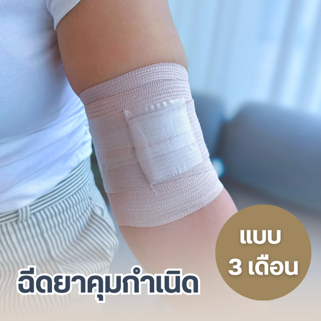 ฉีดยาคุมกำเนิดสำหรับผู้หญิง แบบ 3 เดือน 1 เข็ม