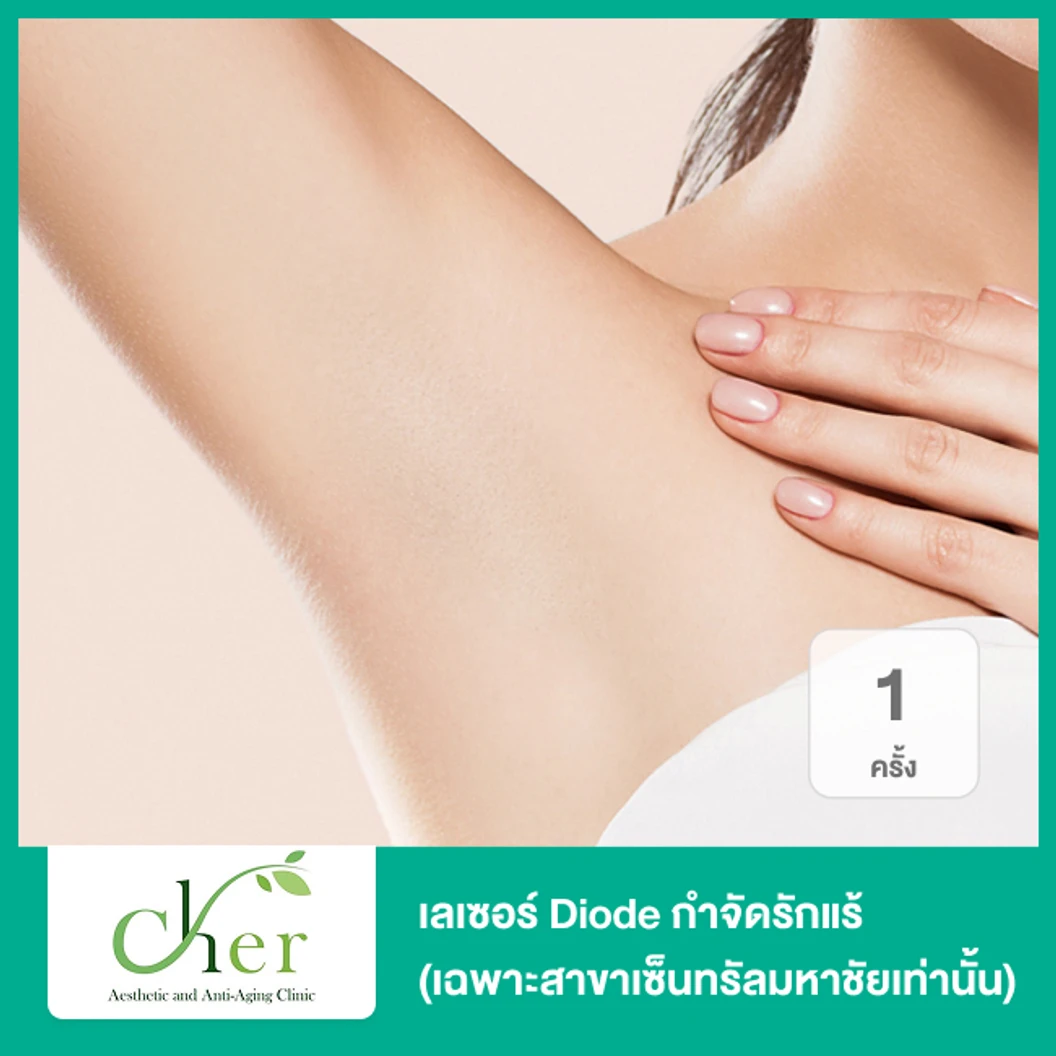 เลเซอร์ Diode กำจัดขนรักแร้ 1 ครั้ง (เฉพาะสาขาเซ็นทรัลมหาชัยเท่านั้น)