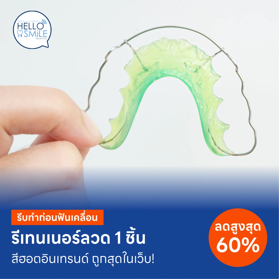 ทำรีเทนเนอร์แบบลวด 1 ชิ้น