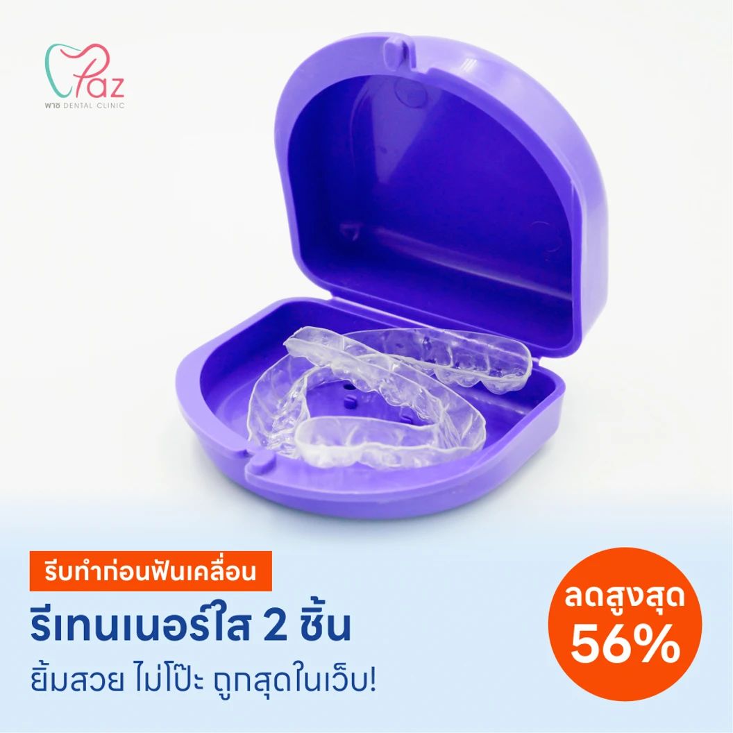 ทำรีเทนเนอร์แบบใส 2 ชิ้น