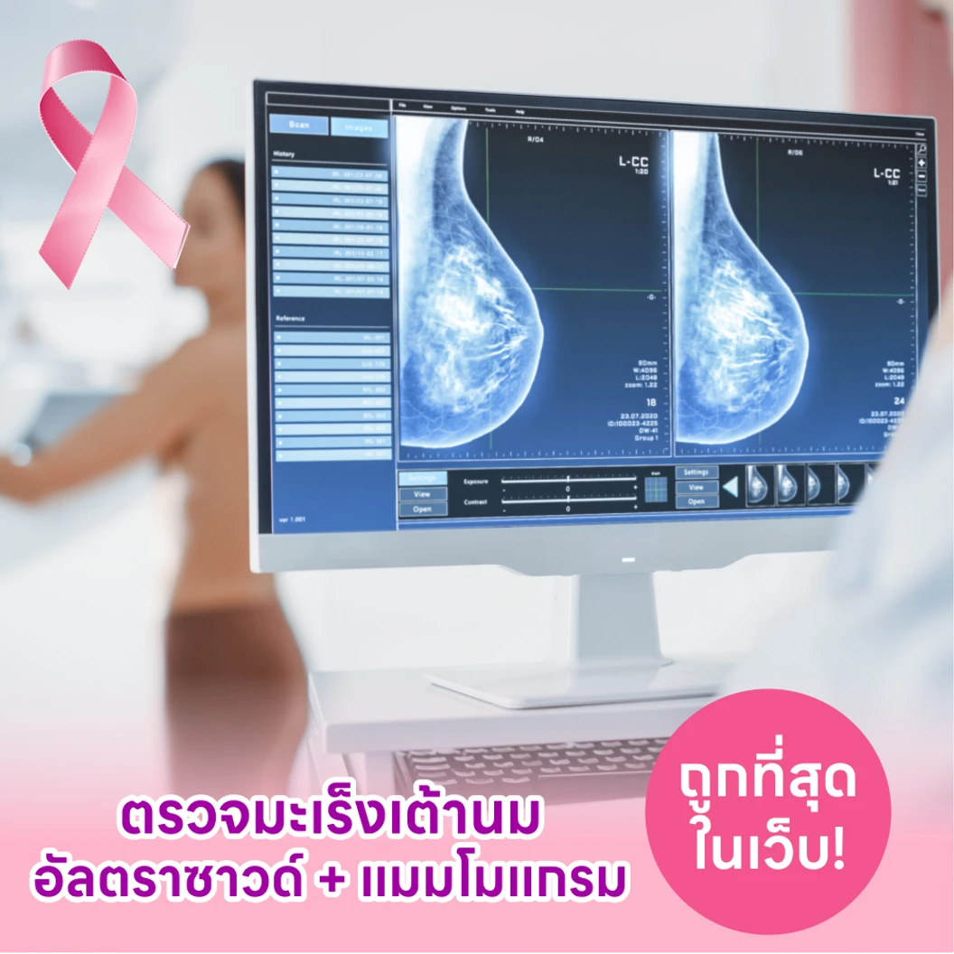 ตรวจคัดกรองมะเร็งเต้านมด้วยวิธีอัลตราซาวด์และแมมโมแกรม (สำหรับผู้หญิงที่เสริมหน้าอก)