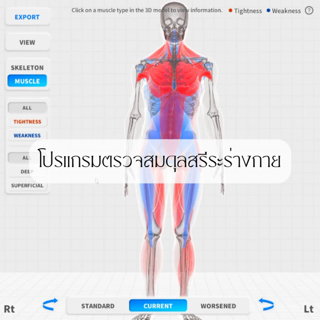 ตรวจสมดุลสรีระของร่างกาย ด้วย AI (โปรแกรม MOTI Physio)