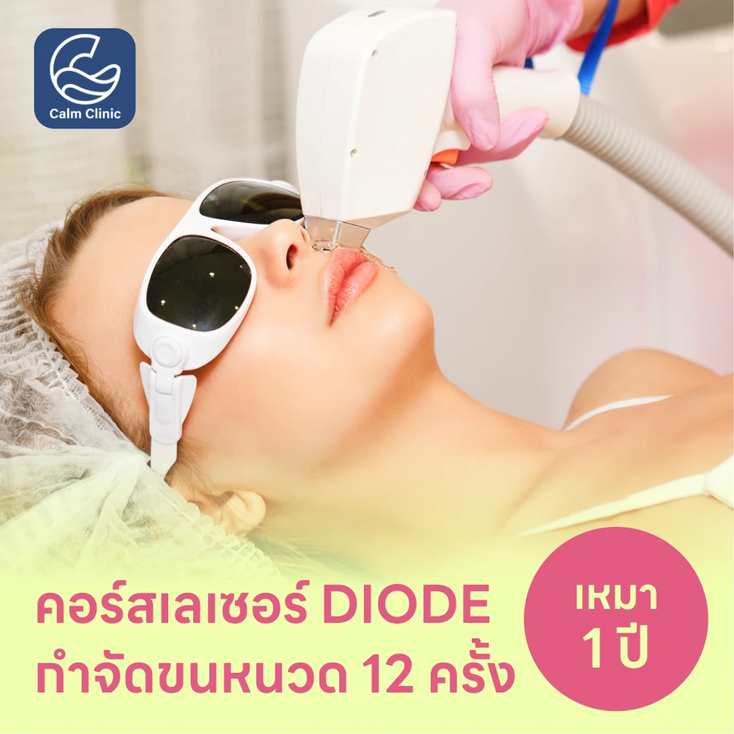คอร์สเลเซอร์กำจัดขนหนวด 12 ครั้ง ด้วย Diode Laser
